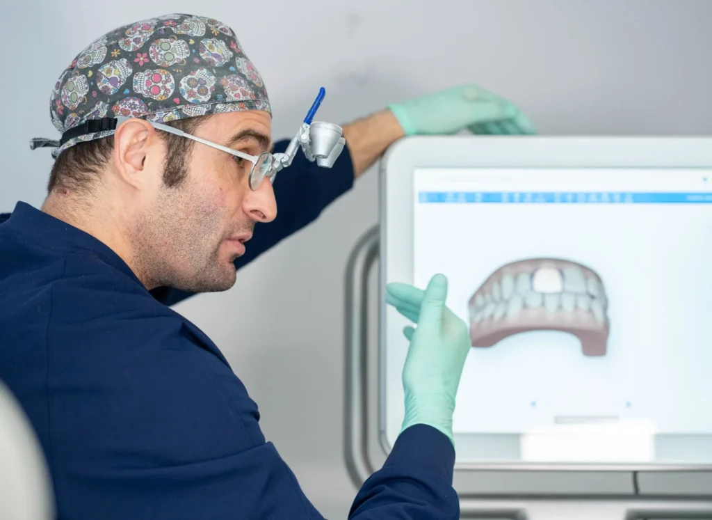 Apparecchio trasparente: le domande più frequenti dei pazienti