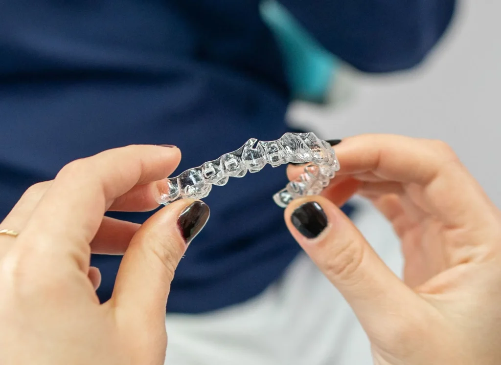 Apparecchio trasparente: le domande più frequenti dei pazienti